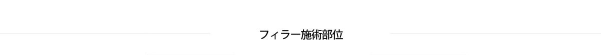 フィラー