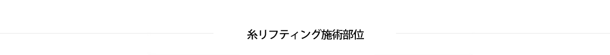 糸リフティング